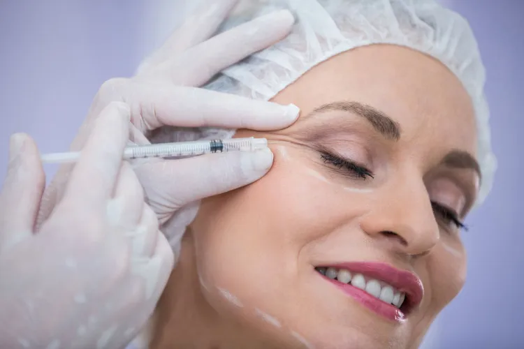 botox tutto quello che devi sapere