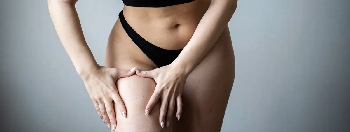 Liposuzione Gambe: Come Funziona, Tecniche, Recupero e Costi