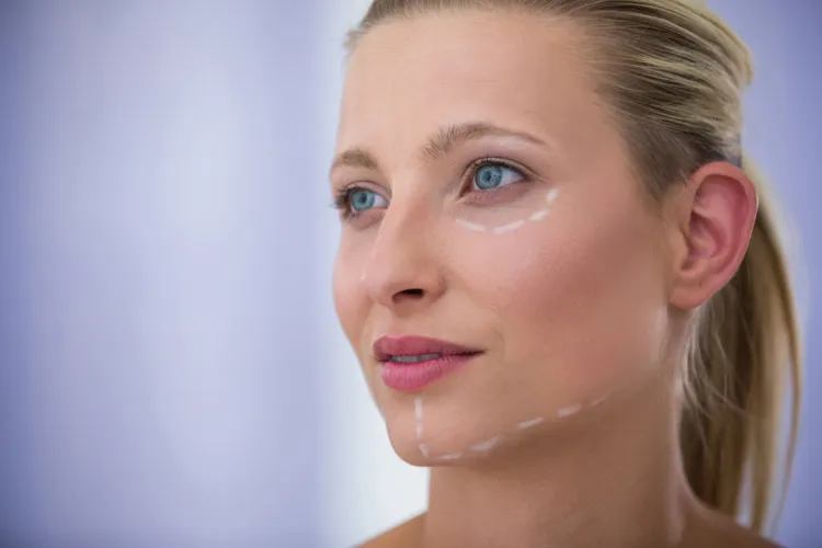 minilifting e lipofilling